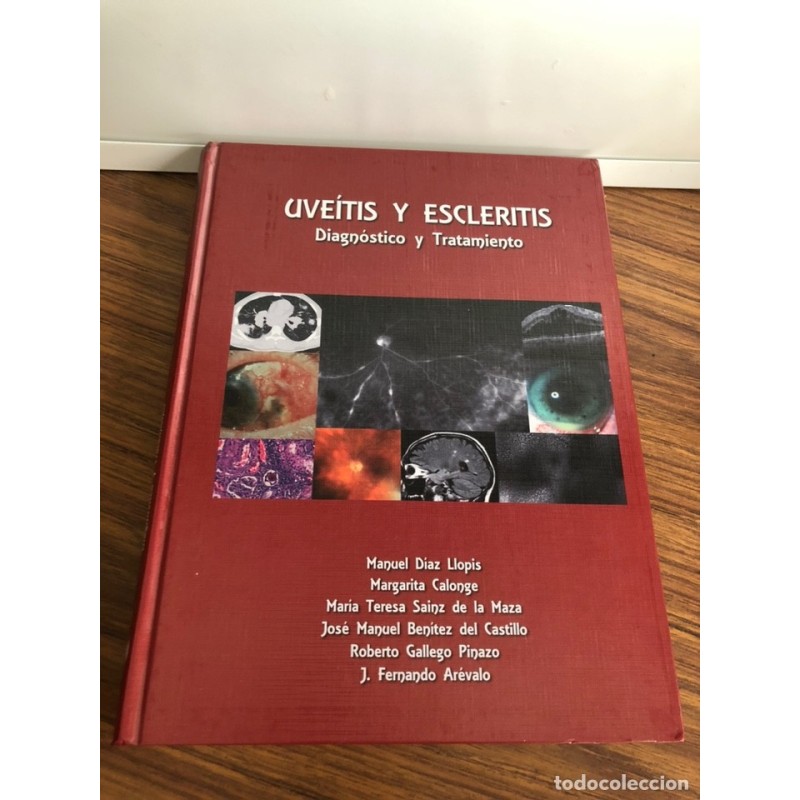 OFTALMOLOGIA-UVEITIS Y ESCLERITIS-DIAGNÓSTICO Y TRATAMIENTO-AÑO 2014. OFTALMOLOGIA-UVEITIS Y ESCLERITIS-DIAGNÓSTICO Y TRATAMIENTO-AÑO 2014.