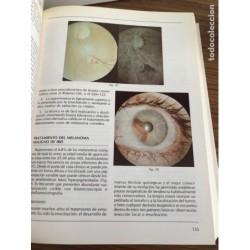OFTALMOLOGIA-PROTESIS OCULARES Y CIRUGÍA RECONSTRUCTIVA DE CAVIDADES-EDITA PRENSA HISPANOAMERICANA.