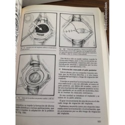 OFTALMOLOGIA-PROTESIS OCULARES Y CIRUGÍA RECONSTRUCTIVA DE CAVIDADES-EDITA PRENSA HISPANOAMERICANA.
