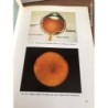 OFTALMOLOGIA-ESTADO Y TRATAMIENTO ACTUAL DE LA RETINOPATIA DIABETICA-EDICIONES DON BOSCO-AÑO 1978