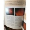 DESPRENDIMIENTO DE LA RETINA Y VITREORRETINOPATIA PROFILERANTE-C. CAPEANS TOME-AÑO 1998.