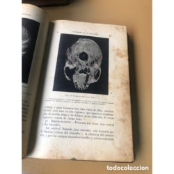 MANUAL DEL PRACTICANTE-ANATOMÍA CIRUGÍA MENOR-OBSTETRICIA-DR. ARTURO CUBELLS BLASCO-3 TOMOS-1903.
